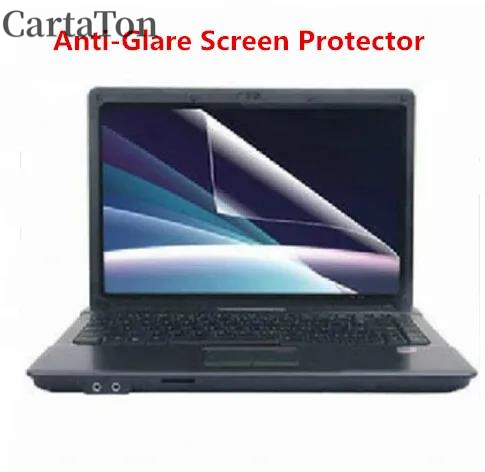 2 uds película protectora de p - Laptop Accessories Must Have reseña y precio