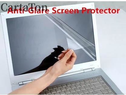 2 uds película protectora de p - Laptop Accessories Must Have reseña y precio